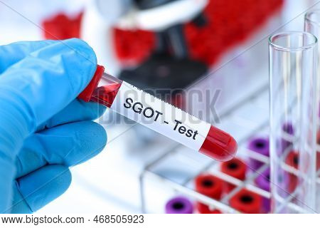 Sgot Test To Look For Abnormalities From Blood,  Blood Sample To Analyze In The Laboratory, Blood In