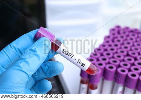 Sgpt Test To Look For Abnormalities From Blood,  Blood Sample To Analyze In The Laboratory, Blood In