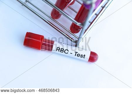 Rbc Test To Look For Abnormalities From Blood,  Blood Sample To Analyze In The Laboratory, Blood In 