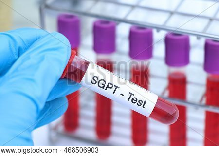Sgpt Test To Look For Abnormalities From Blood,  Blood Sample To Analyze In The Laboratory, Blood In