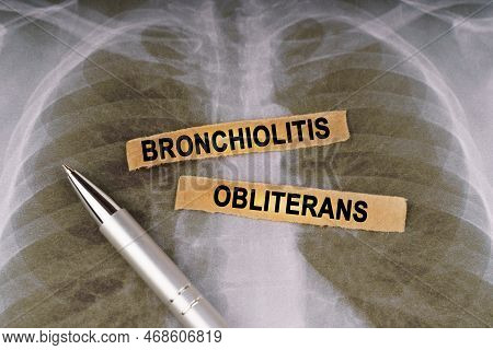 Medical Concept. On A Human Chest X-ray, A Pen And Strips Of Paper Labeled - Bronchiolitis Obliteran
