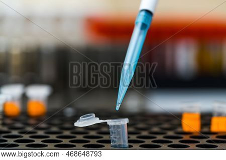 Close Up For Hand Medical Technicians Working On Culture Bacteria And Drug Resistance Of Pathogens I