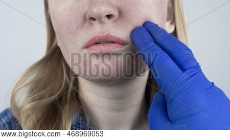 Enlarged Pores. Close-up Of Skin With Large Pores. Dermatology And Cosmetology. Treatment Of Problem