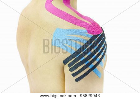 Shoulder kinesiotaping