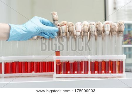 Hand of a lab technician holding blood tube test and background a rack of tubes with blood samples other patients. Laboratory technician holding a blood tube test