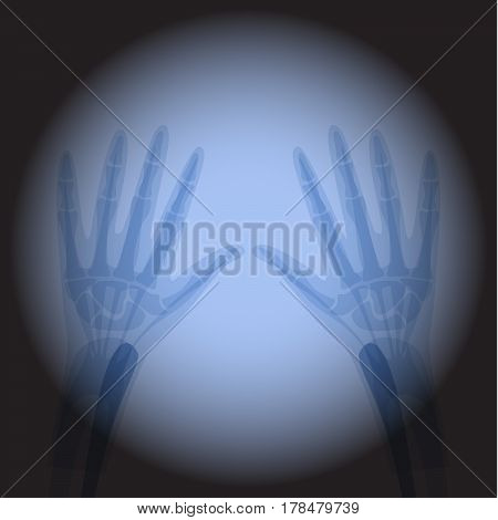 X Ray radiology hand. Healthcare. Treatment for internal oragns and bones.