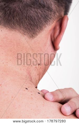 Finger Embrace Mole On Neck And Shoulder Of Asian Male