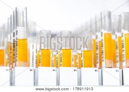 Laboratory glass test tubes filled with orange liquid for an experiment in a science research lab. Analyzes