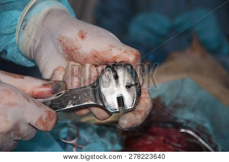 A Fragment Of A Surgery. The Surgeon Prepares A Plate For Fixing The Bone