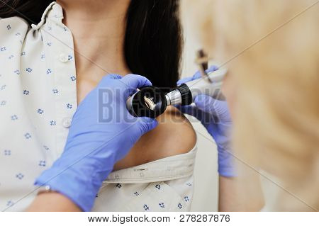 Doctor Examining Birthmarks And Moles Patient. Examination Of Birthmarks And Moles.the Doctor Examin