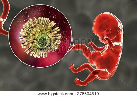 Concept For Prevention Of Hiv Transplacental Transmission. 3d Illustration Showing Destruction Of Hu