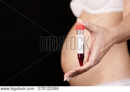 A Pregnant Woman Holds A Test Tube Of Blood In Front Of Her. Pregnancy, Blood Control In The Laborat