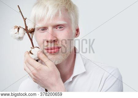 Albinism Happy Smile Albino Man White Skin Hair Soft Fluffy Cotton Brunch Studio Dressed T-shirt Iso