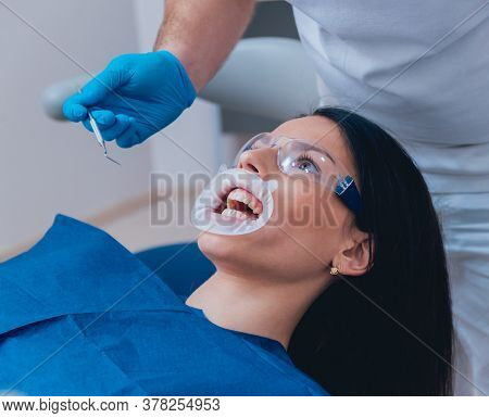 Installation Of The Expander, Preparation For The Photo Protocol