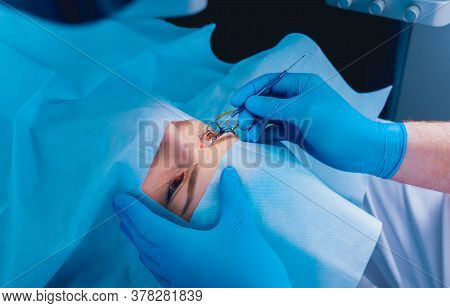 Laser Vision Correction. A Patient And Team Of Surgeons In The Operating Room