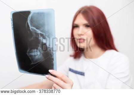 Dentist Doctor Checking Dental X-ray Orthopantomogram. Dental Panoramic Radiography