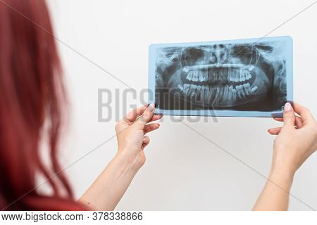 Dentist Doctor Checking Dental X-ray Orthopantomogram. Dental Panoramic Radiography