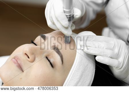The Photo Conveys The Moment Of Fractional Mesotherapy, Emphasizing The Professionalism And Experien
