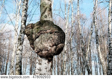 Inonotus Obliquus Or Chaga Mushroom On Trunk Birch Tree. It Is Also Known As The Clinker Polypore, C