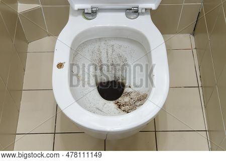 The Bathroom Had A Clogged Drain That Required Immediate Attention. Without Proper Unclogging, The D