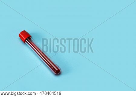Test Tube With Blood On A Blue Background With Copy Space.