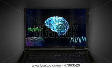 Gehirnwelle ist auf Laptop-Bildschirm