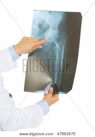 Detailní záběr na doktora ženy ukazující na Fluorography