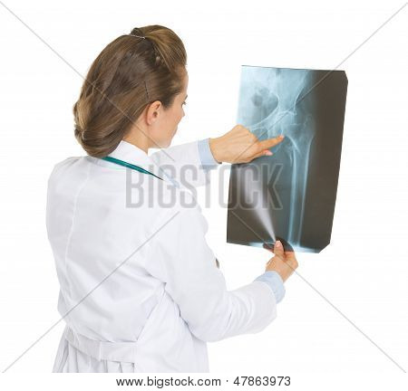 Doktor žena ukazující na Fluorography. Zadní pohled