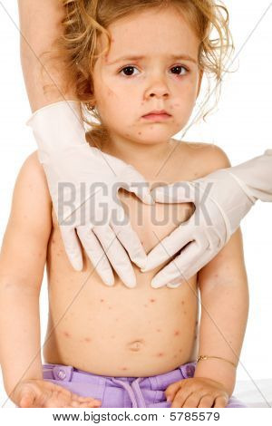 天然痘、医師と悲しい少女