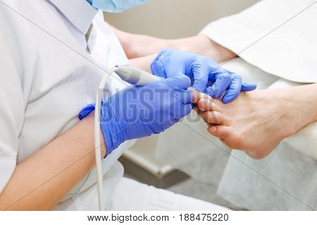 Master chiropody shapes the nails . Male patient in the process of hardware pedicure procedure. Concept body care. Close up, selective focus.