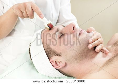 The Man Undergoes The Procedure Of Medical Micro Needle Therapy With A Modern Medical Instrument Der