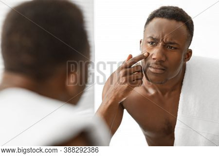 Problem Skin. Sad African American Man Touching Acne Pimple On Face Looking At His Reflection In Mir
