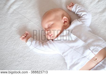 Portrait Of A Newborn Baby With Seborrhea Sleeping On A White Blanket.