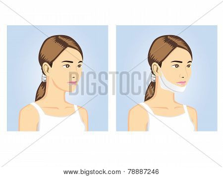 Beauty Women with v-shape mask