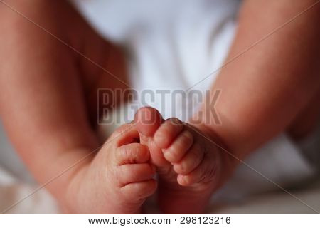 Feet Of A Newborn Baby Boy Without Socks Clubfoot Hip Dysplasia