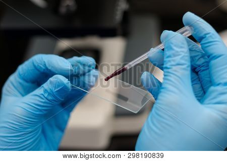 The Veterinarian Putting A Drop Of Blood On The Surface Of A Microscopic Blade