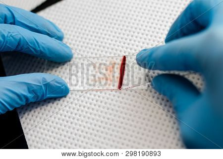 The Veterinarian Is Preparing A Blood Smear