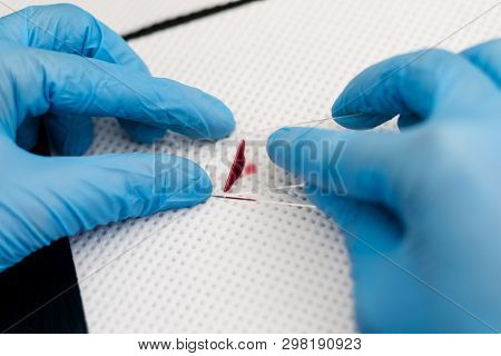 The Veterinarian Is Preparing A Blood Smear