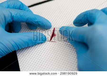 The Veterinarian Is Preparing A Blood Smear