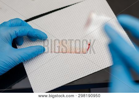 The Veterinarian Is Preparing A Blood Smear