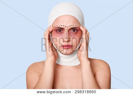 Photo Of Tired Girl On Blue Background. Woman With Bruise Around Eyes And Bandages On Head Has Heada