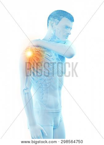 3d rendered medically accurate illustration of a man having a painful shoulder joint