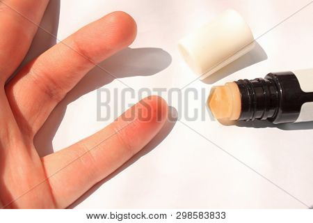 A Finger Stung By A Bee. Female Hand With An Insect Bite, Isolated On White Background, Copy Space.