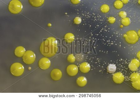 Bacteria Grown From Skin Smear, Colonies Of Micrococcus Luteus And Staphylococcus Epidermidis On Pet