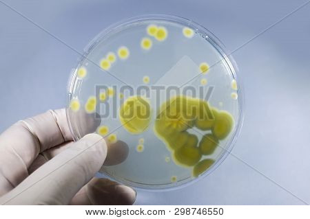 Colonies Of Penicillium Fungi Grown On Sabouraud Dextrose Agar, Photo Showing Yellow Reverse Side. P