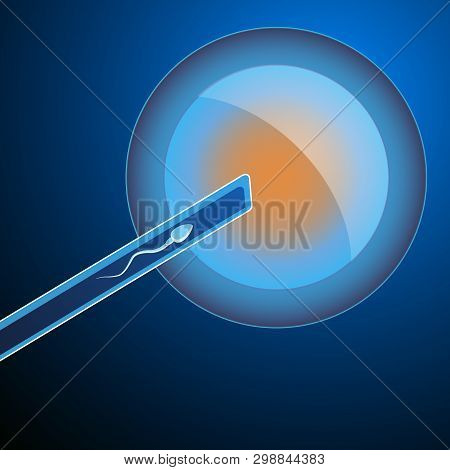 Artificial Insemination. The Fertilized Egg, Washed, Injected Sperm, Uterus, Womb, Syringe. In Vitro
