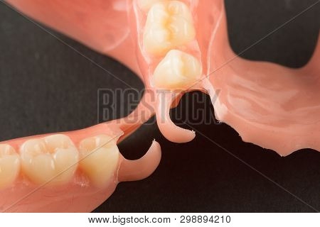Large Image Of A Modern Nylon Denture On A Black Background