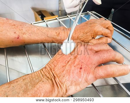 Clean Dressing Abrasion Wound From Dog’s Bite At Arm Of Patient, Medical Emergency Concept