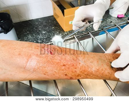 Clean Dressing Abrasion Wound From Dog’s Bite At Arm Of Patient, Medical Emergency Concept