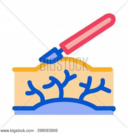Surgery Treatment Varicose Veins Color Icon Vector. Surgery Treatment Varicose Veins Sign. Isolated 